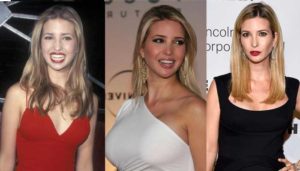 ivanka trump plastic surgery before and after photos