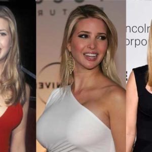 Ivanka Trump Plastic Surgery