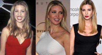 Ivanka Trump Plastic Surgery
