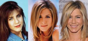 jennifer aniston plastic surgery before and after photos