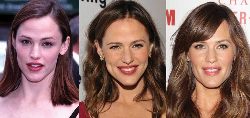 jennifer garner plastic surgery before and after photos