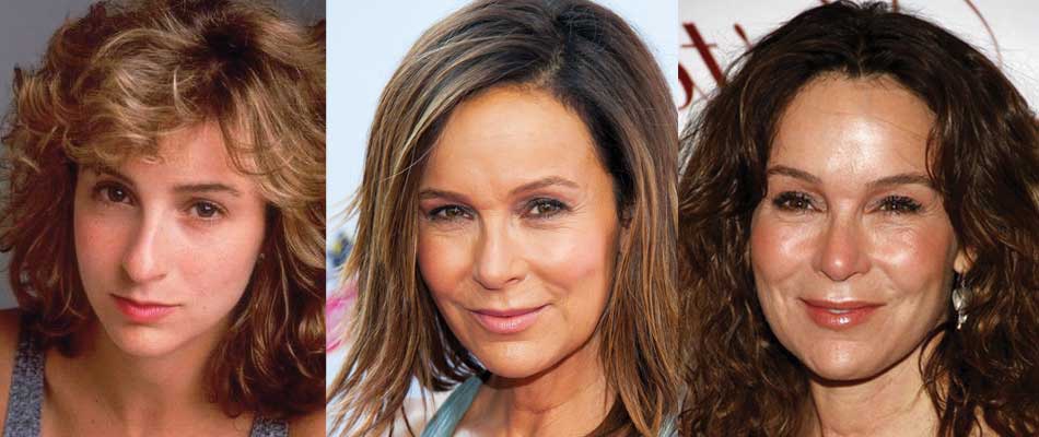 jennifer grey plastic surgery before and after photos