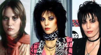 Joan Jett Plastic Surgery