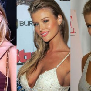 Joanna Krupa Plastic Surgery