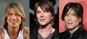 johnny rzeznik plastic surgery before and after