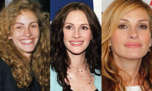 julia roberts plastic surgery before and after photos