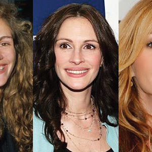 Julia Roberts Plastic Surgery