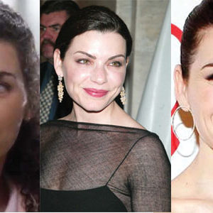 Julianna Margulies Plastic Surgery