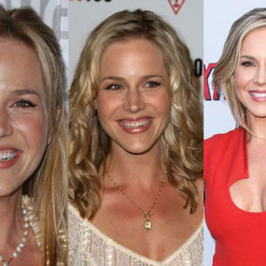 Julie Benz Plastic Surgery