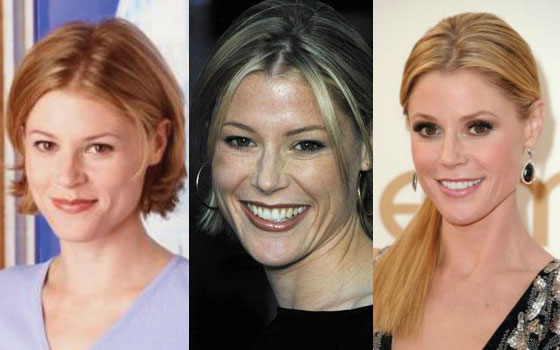 julie bowen plastic surgery before and after photos 2024