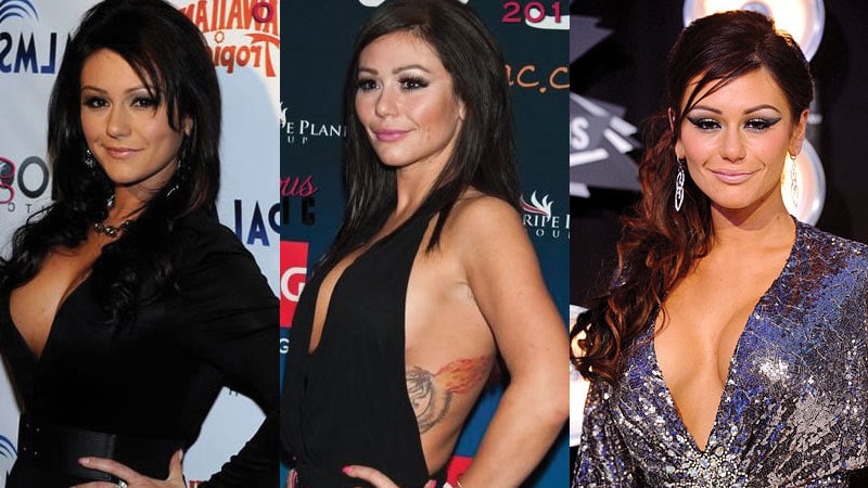 jwoww before and after plastic surgery 2022