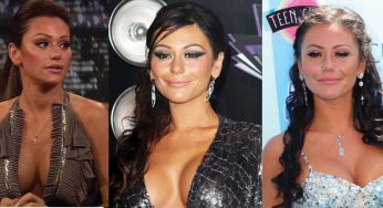 Jwoww Plastic Surgery