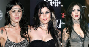 kat von d before and after plastic surgery
