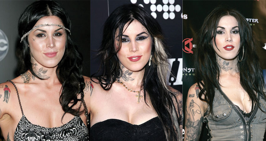kat von d before and after plastic surgery 2023