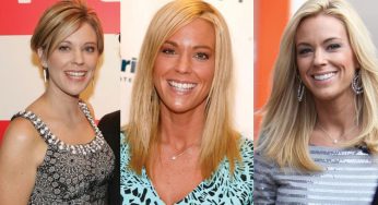 Kate Gosselin Plastic Surgery