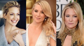 Kate Hudson Plastic Surgery
