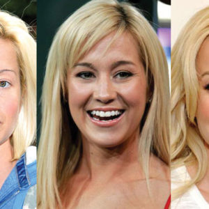 Kellie Pickler Plastic Surgery