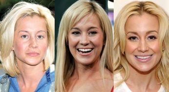 Kellie Pickler Plastic Surgery