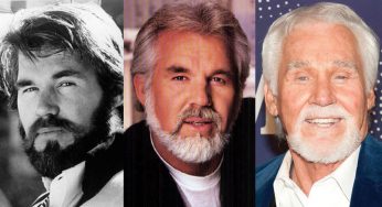 Kenny Rogers Plastic Surgery