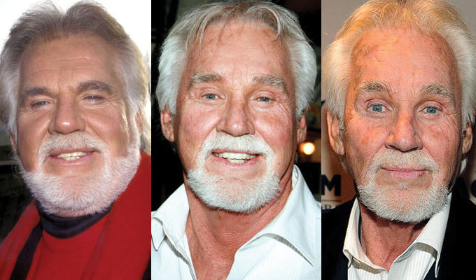 kenny rogers plastic surgery before and after 2022