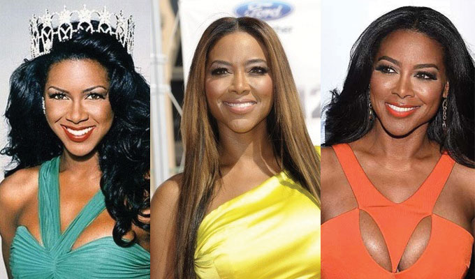 kenya moore plastic surgery before and after 2023