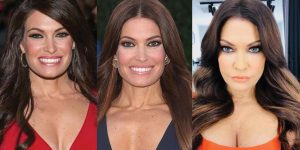 Kimberly Guilfoyle Plastic Surgery Before and After Pictures 2025
