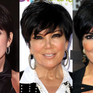 Kris Jenner Plastic Surgery