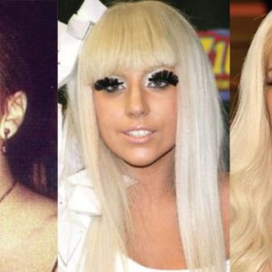 Lady Gaga Plastic Surgery