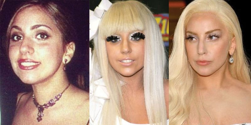 lady-gaga-plastic-surgery-before-and-after.jpg