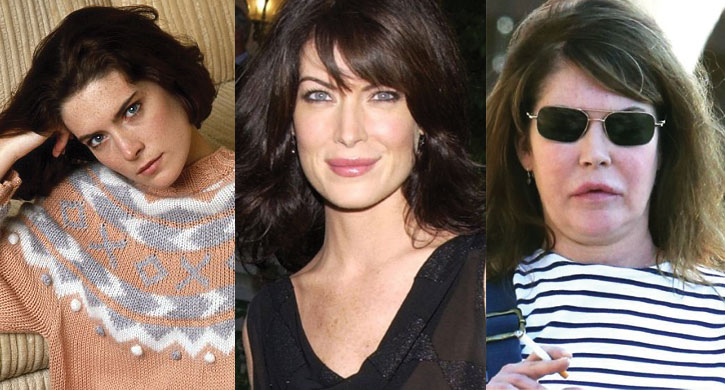 lara flynn boyle before and after plastic surgery 2024