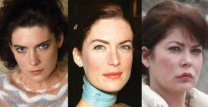 lara flynn boyle plastic surgery before and after