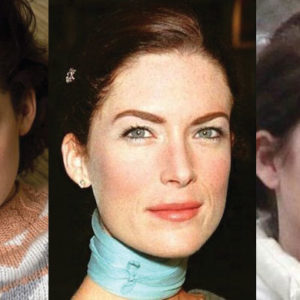 Lara Flynn Boyle Plastic Surgery