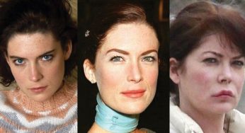 Lara Flynn Boyle Plastic Surgery