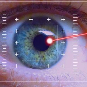 Laser Eye Surgery Cost in USA