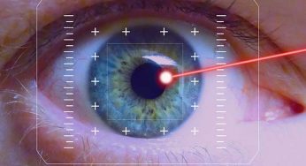 Laser Eye Surgery Cost in USA