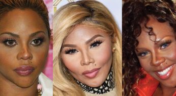 Lil’ Kim Plastic Surgery