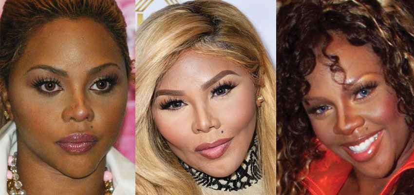 lil kim plastic surgery before and after 2022