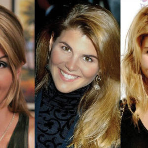 Lori Loughlin Plastic Surgery