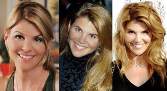 Lori Loughlin Plastic Surgery
