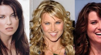 Lucy Lawless Plastic Surgery