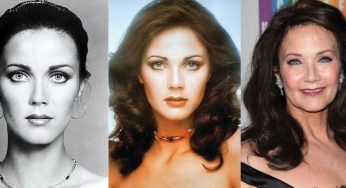 Lynda Carter Plastic Surgery