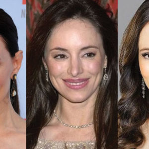 Madeleine Stowe Plastic Surgery