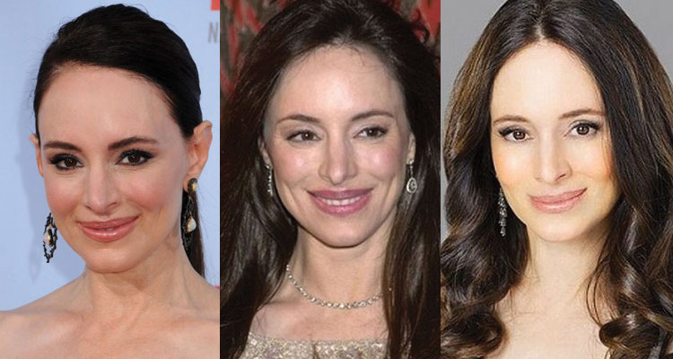 madeleine stowe plastic surgery before and after