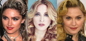 madonna plastic surgery before and after