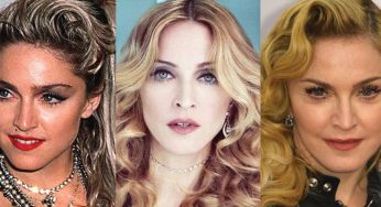 Madonna Plastic Surgery