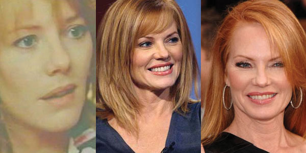 marg helgenberger plastic surgery before and after photos 2023