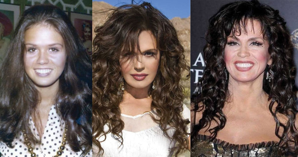marie osmond before and after plastic surgery 2022