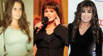 Marie Osmond Plastic Surgery