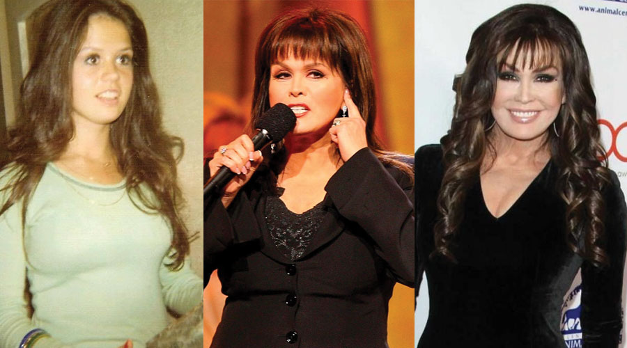 Marie Osmond Plastic Surgery Before and After Pictures 2022.