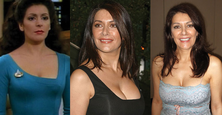 Marina Sirtis Before and After Plastic Surgery.